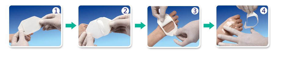 usuage- I.V.Cannula Fixing Dressing