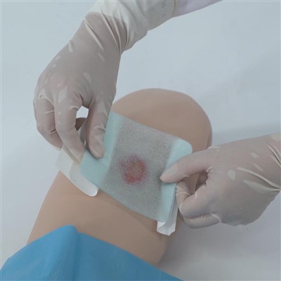 Bordered Hydrogel Wound Dressing for Minor Burns
