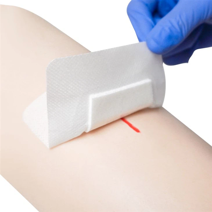 wound dressing (3)