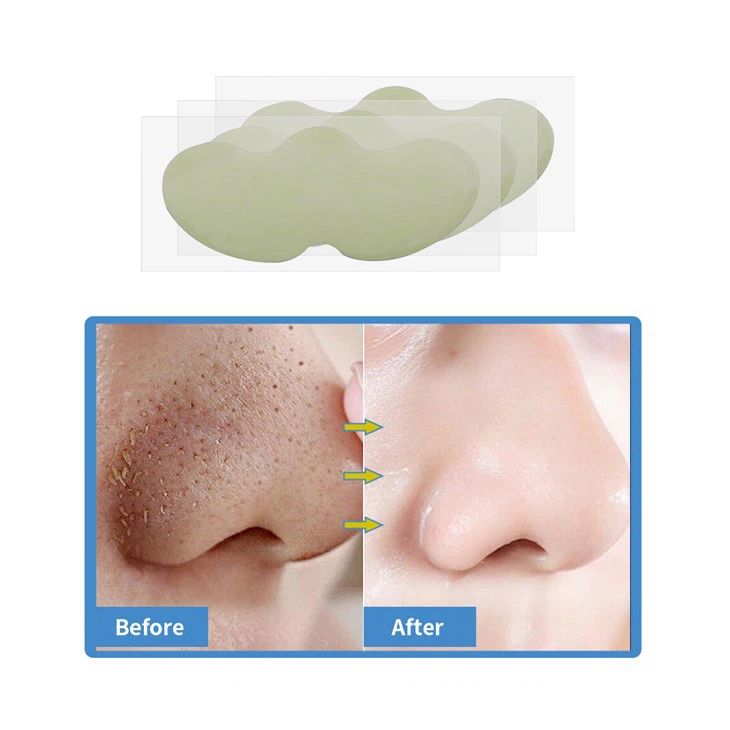 pore strips (9)