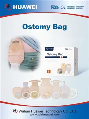 Constipation After Ostomy Surgery: A Complete Guide To Safe Management