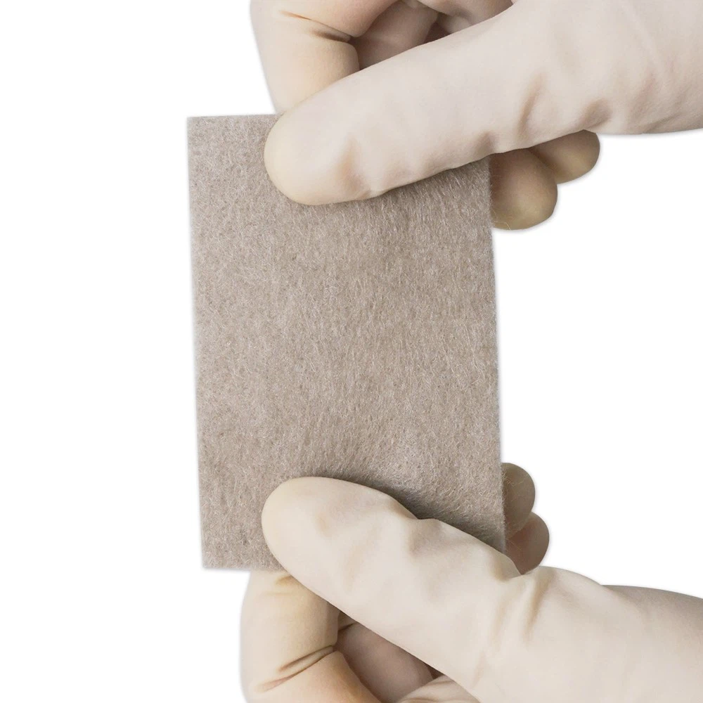 Alginate dressing 9 Alginate dressing 9