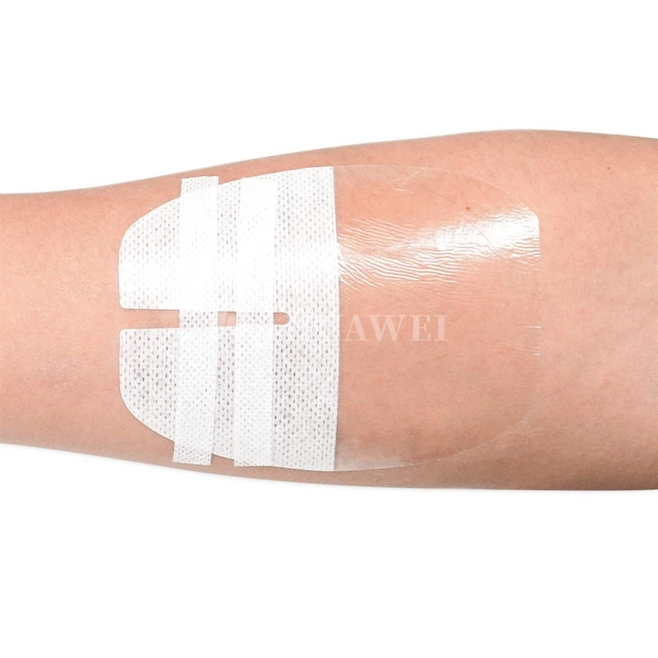 Waterproof I.V. Transparent Film Dressing manufacturers